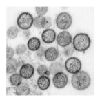Informacion Hantavirus – 3D Control de Plagas 